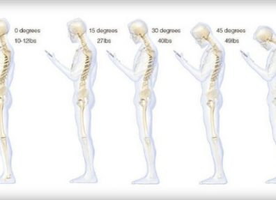 El abuso del móvil puede modificar la postura